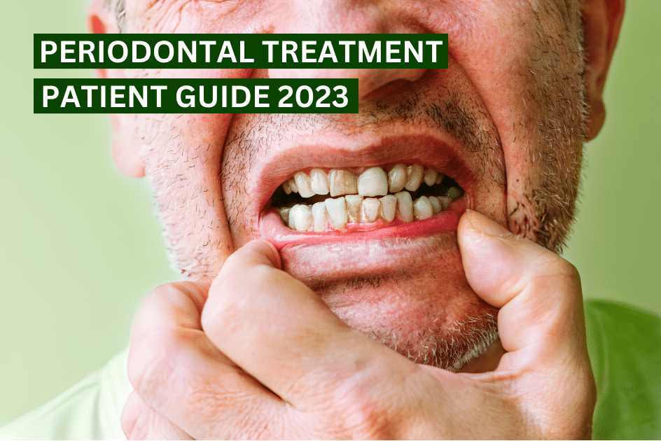 Periodontal Treatment, visible gum disease