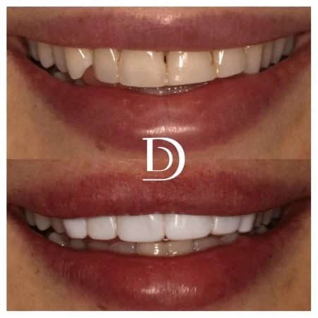 DDC - Before&After - Post Format (1)-min